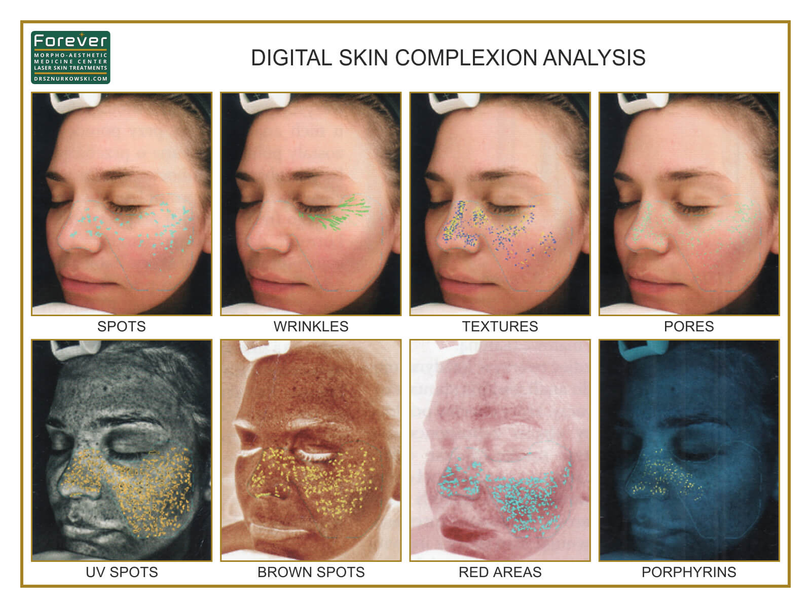 Digital Skin Complexion Analysis (80x60) EN.jpg