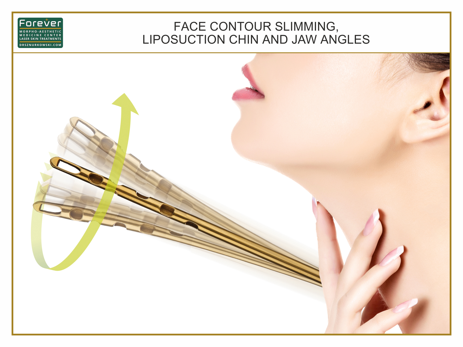 Face Contour Slimming, Liposuction Chin and Jaw Angles.jpg