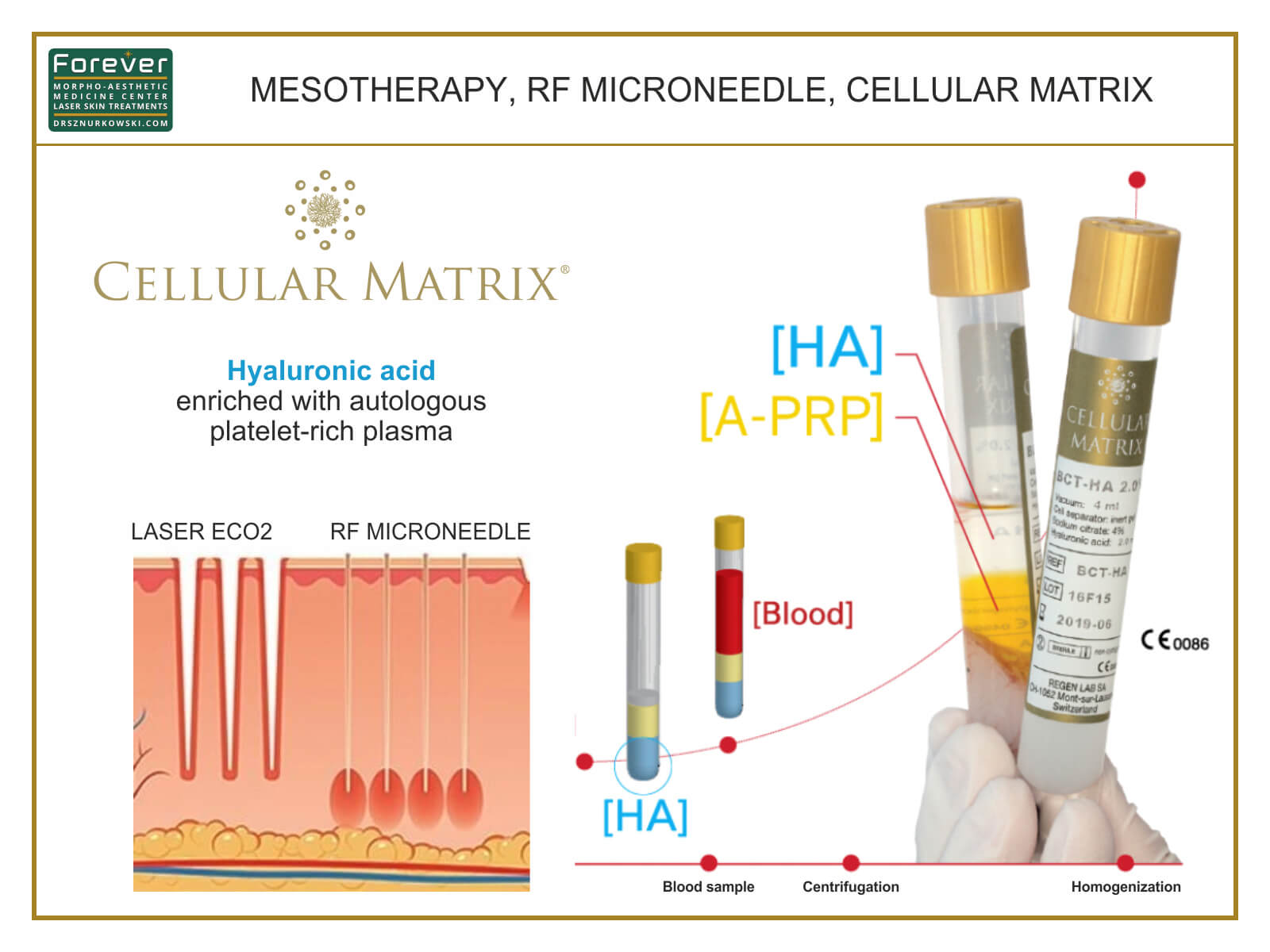 Mesotherapy, RF Microneedle, Cellular Matrix (80x60) EN.jpg