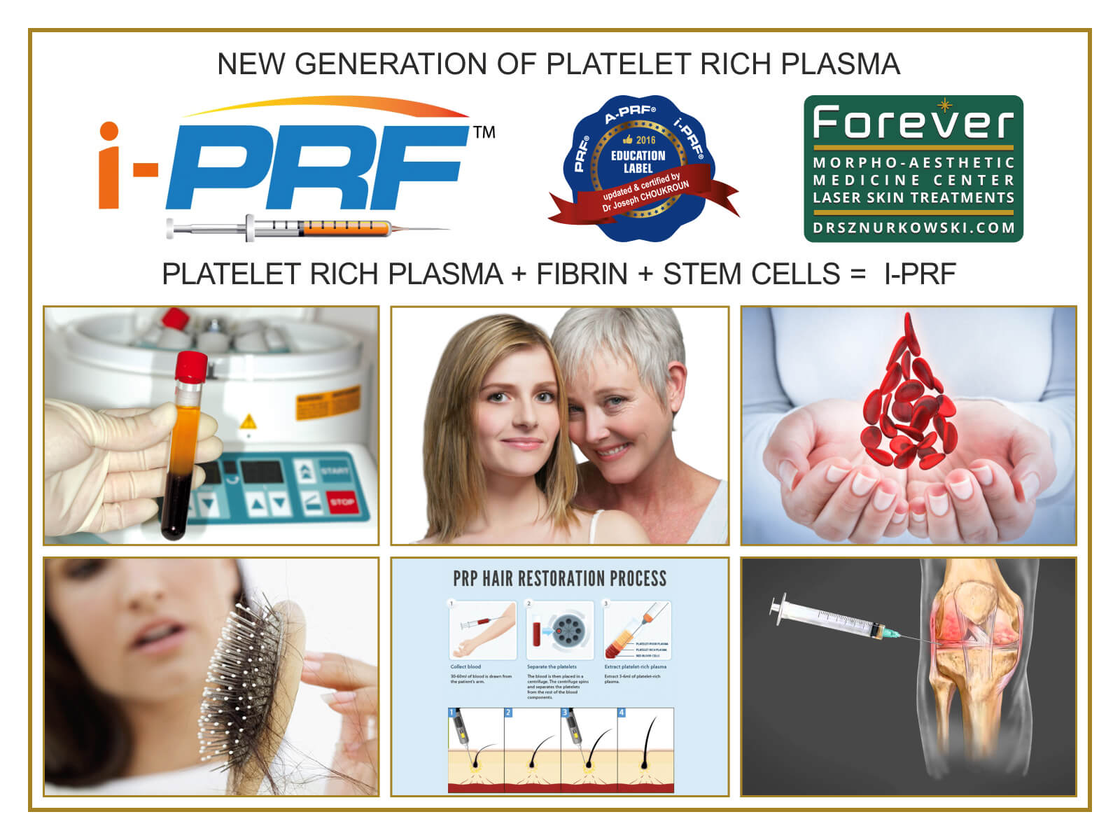 New Generation of Platelet Rich Plasma (80x60) EN.jpg
