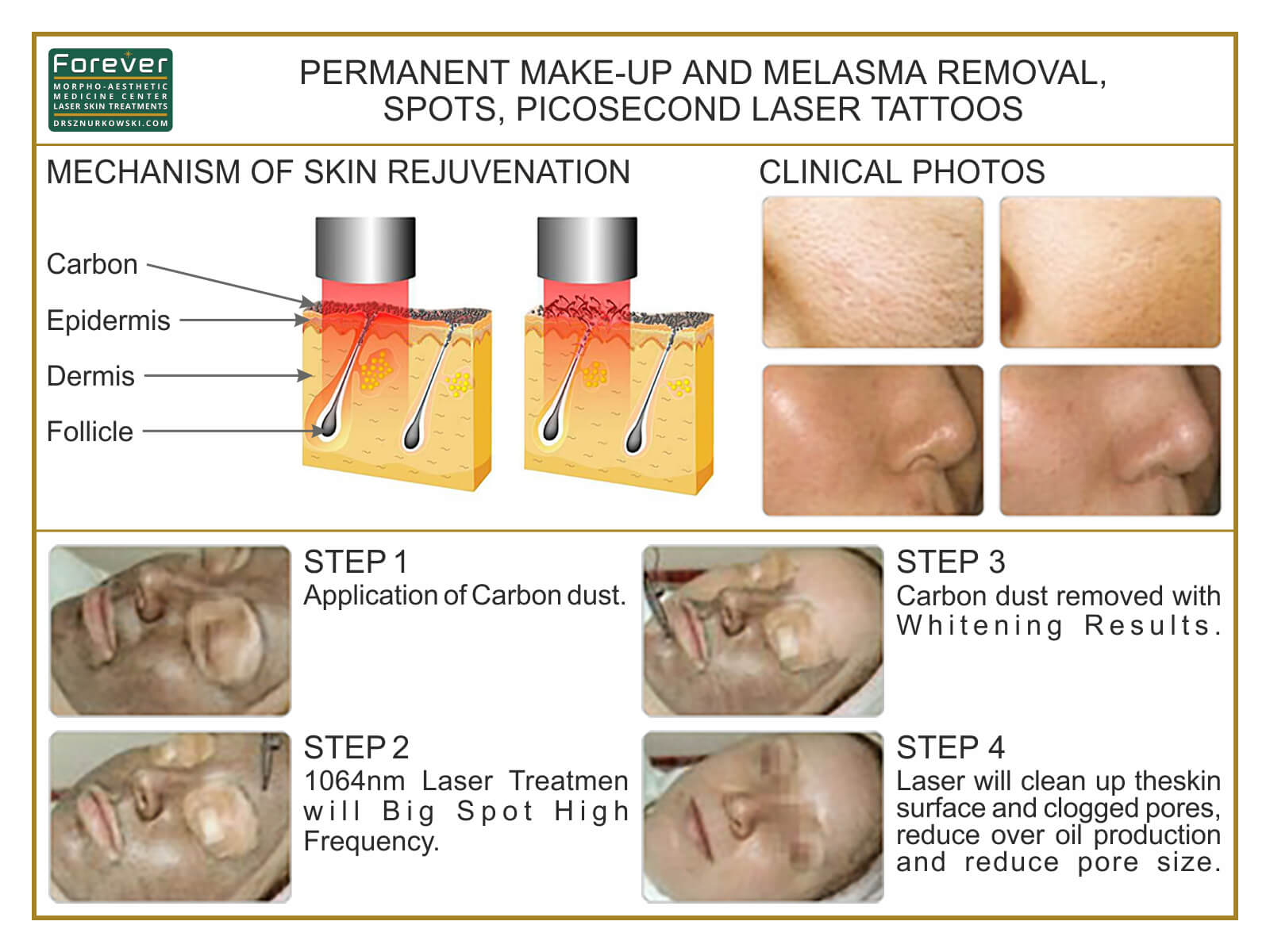Permanent Make-up And Melasma Removal, Spots, Picosecond... (80x60) EN.jpg