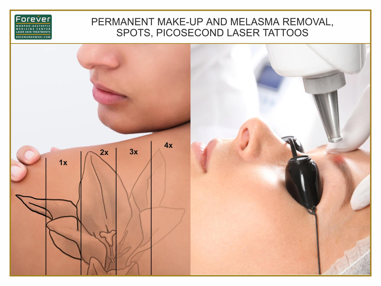 Permanent Make-up and Melasma Removal, Spots 1 (80x60) EN.jpg