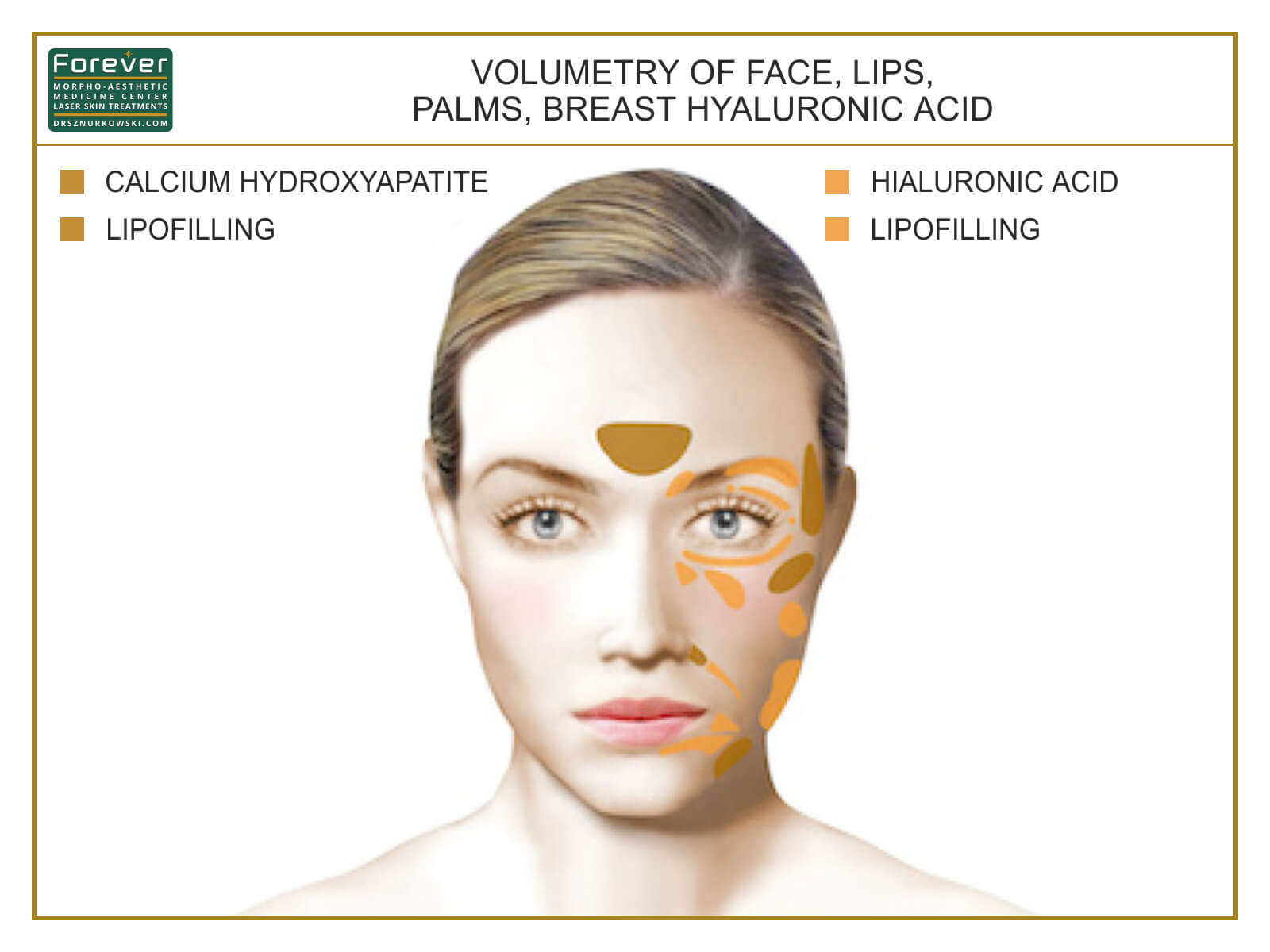 Volumetry of Face, Lips, Palms, Breast Hyaluronic Acid (80x60) EN.jpg