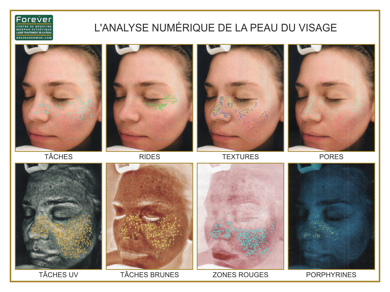 Digital Skin Complexion Analysis (80x60) FR.jpg