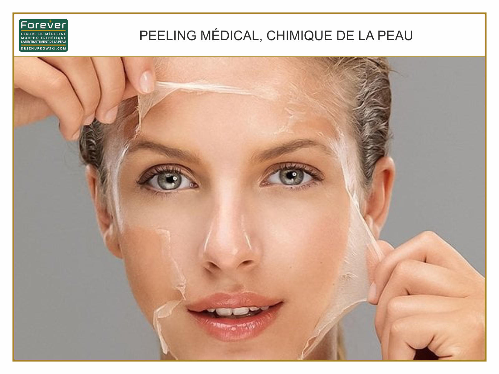 Medical, Chemical Skin Peel 1 (80x60) FR.jpg