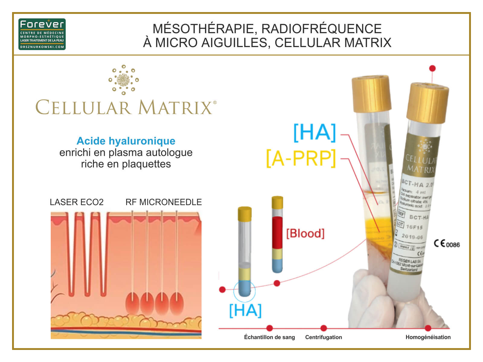 Mesotherapy, RF Microneedle, Cellular Matrix (80x60) FR.jpg