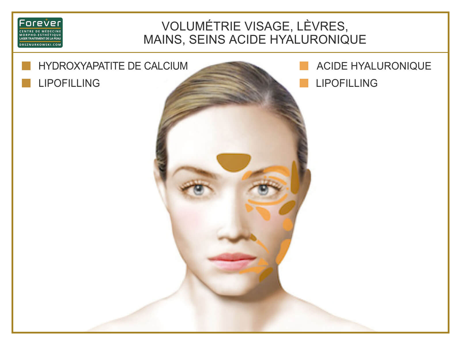 Volumetry of Face, Lips, Palms, Breast Hyaluronic Acid (80x60) FR.jpg