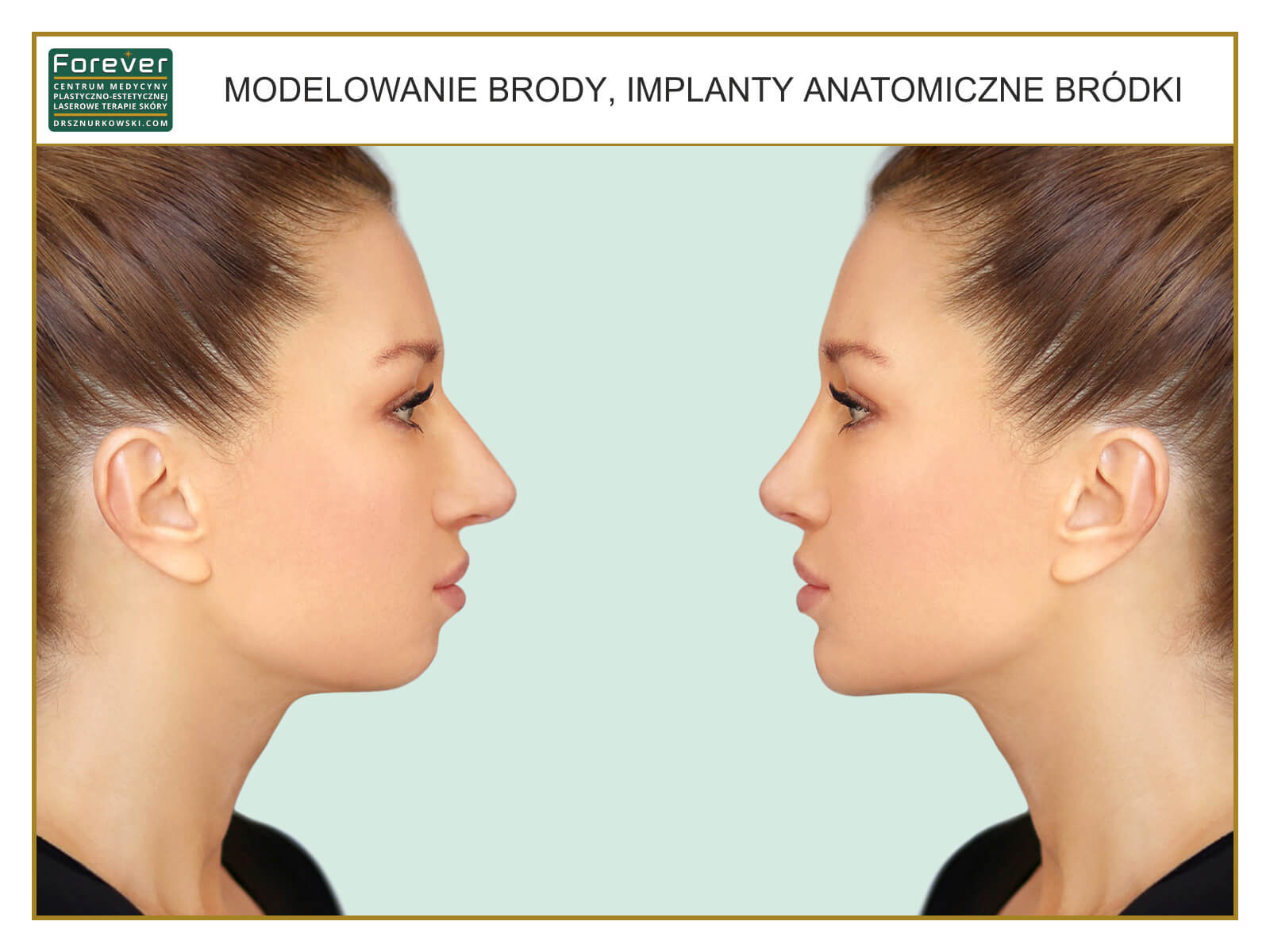 Facial Slimming, Anatomical Implants, Chin Augmentation (80x60) PL.jpg