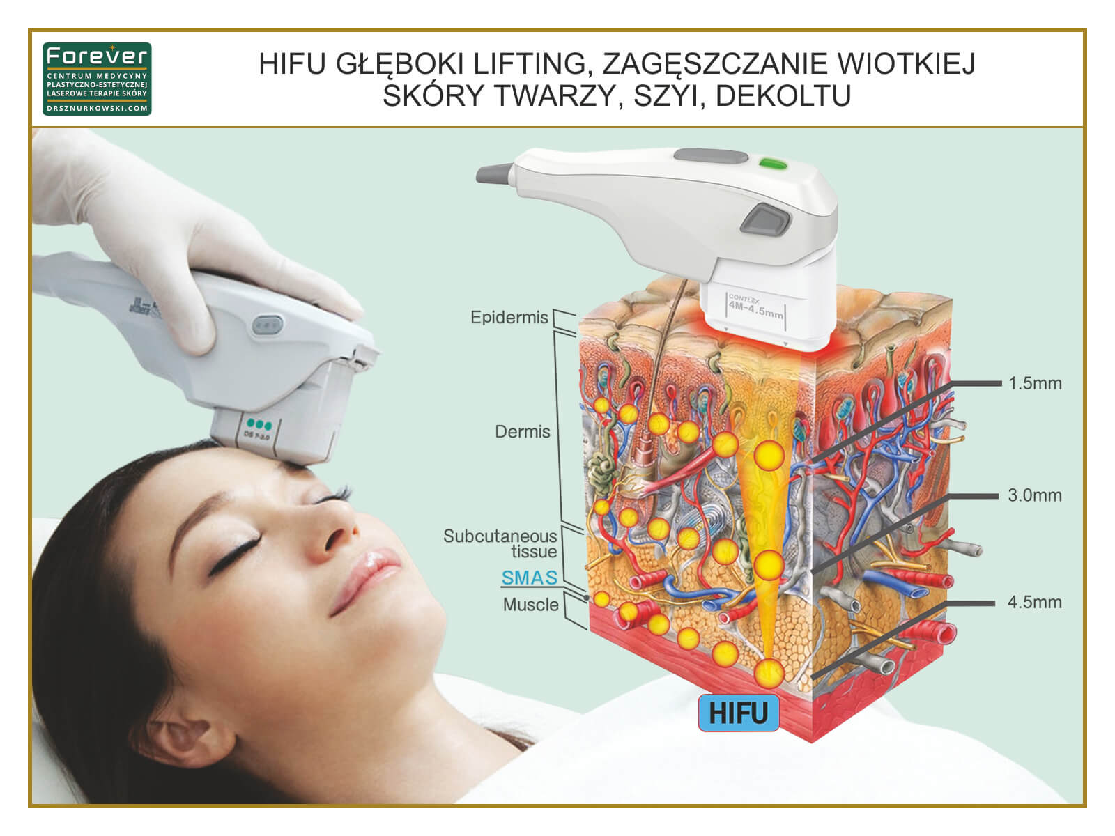 HIFU Technology Deep Ultrasound Face Lift, Skin Tightening... (80x60) PL.jpg