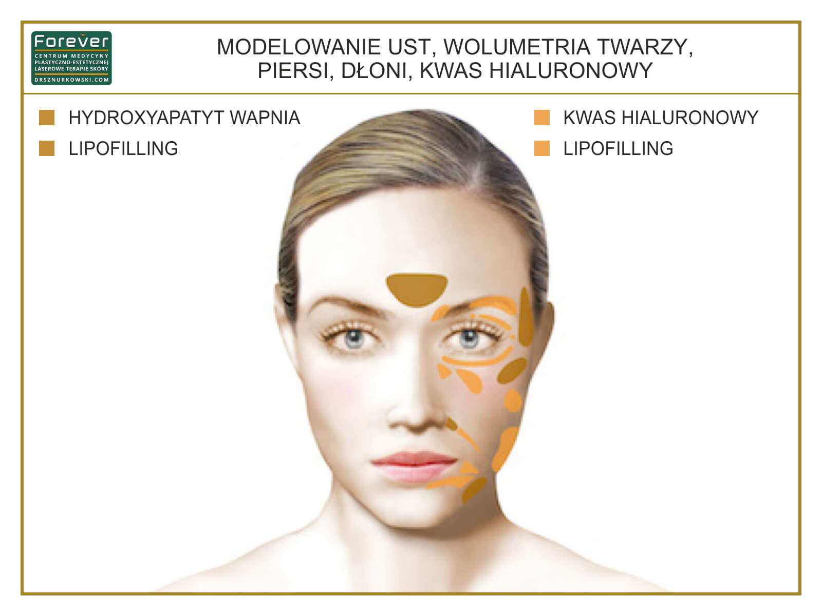 Volumetry of Face, Lips, Palms, Breast Hyaluronic Acid (80x60) PL.jpg